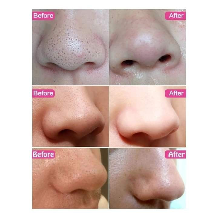 APK Deep Cleansing Nose Pore Strip (Each strip)